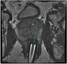 prostate_mri_2 prostate_mri_2